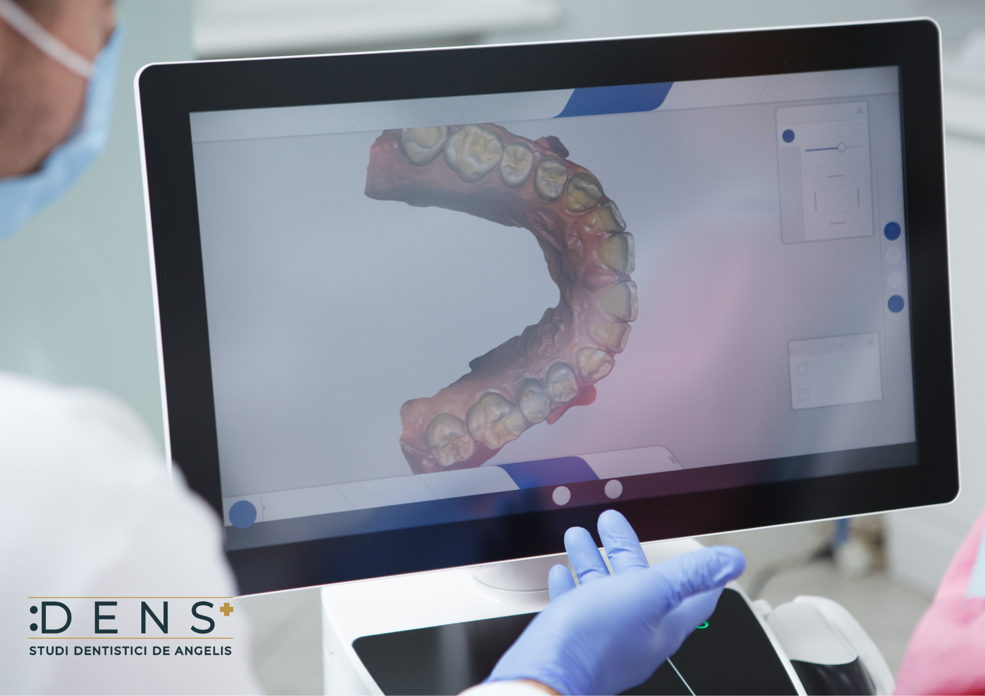 Simulazione digitale del sorriso con Digital Smile Design durante una consulenza odontoiatrica