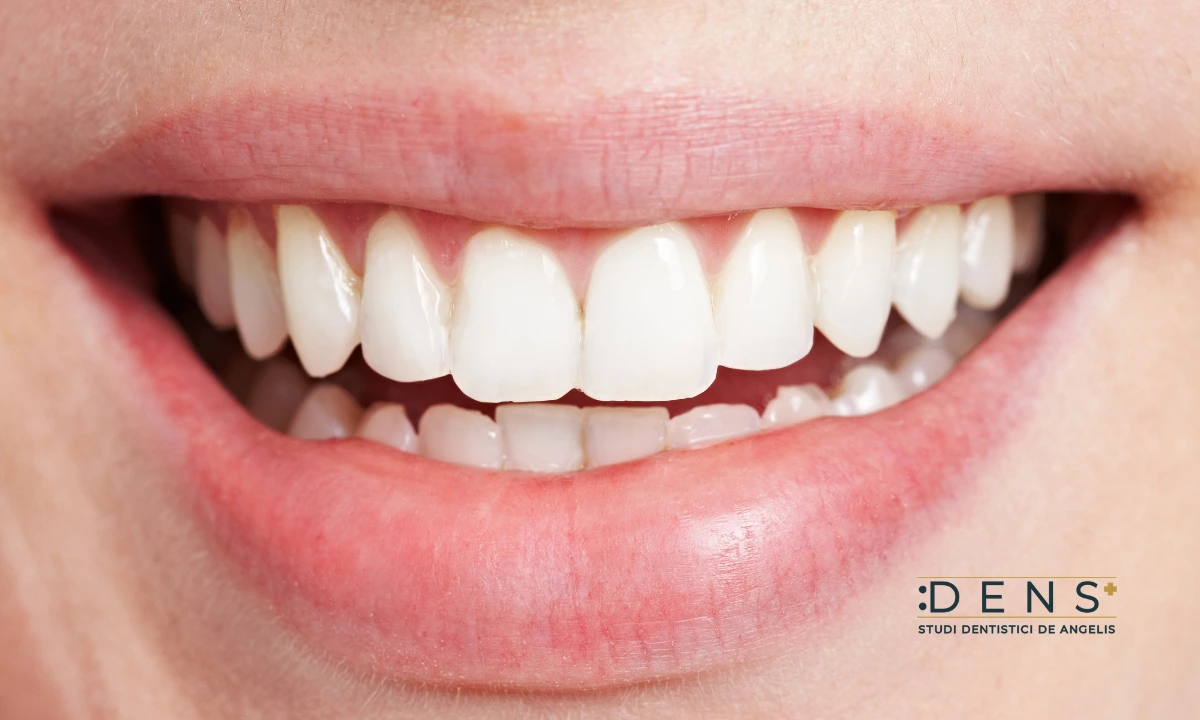 Sorriso naturale con denti fissi dall’aspetto armonioso e realistico